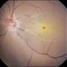 Prakash Eye Centre in Agra city