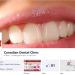 Canadian Dental Clinic in Al Ain city