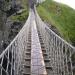 Ponte di corda di Carrick-a-Rede