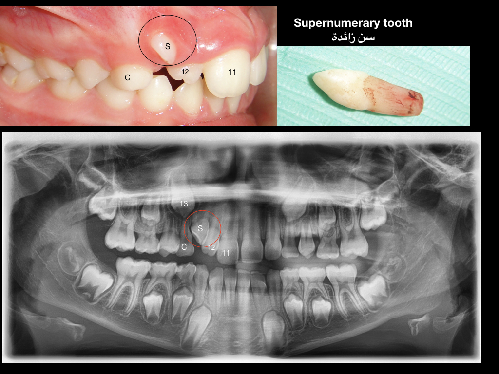 Mheissen Orthodontic Centre MOC (مركز تقويم الأسنان والفكين التخصصي ...